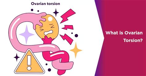 safety precautions for torsion test|ovarian torsion signs and symptoms.